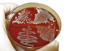 mileux de culture microbiologie tunisie